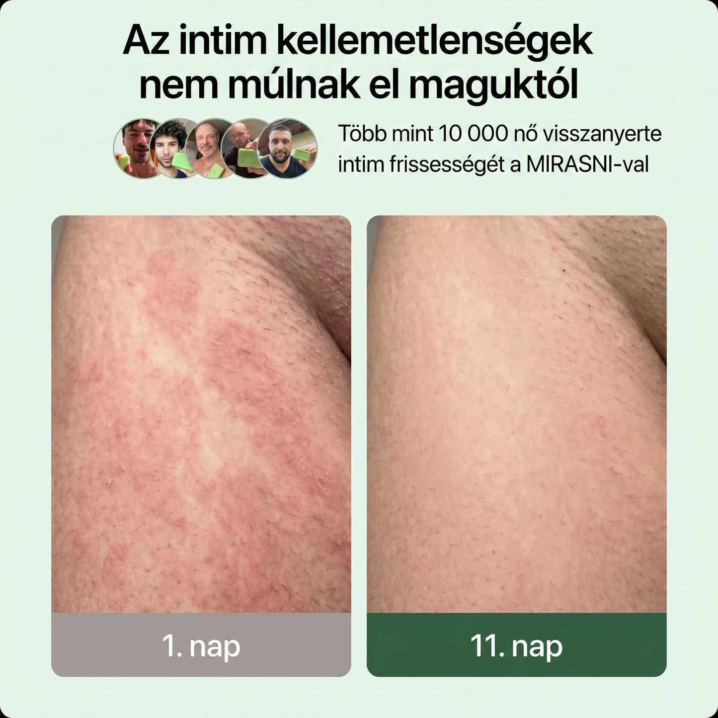 Veloma Gombaellenes Szappan